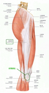 iliotibial-lig.jpg